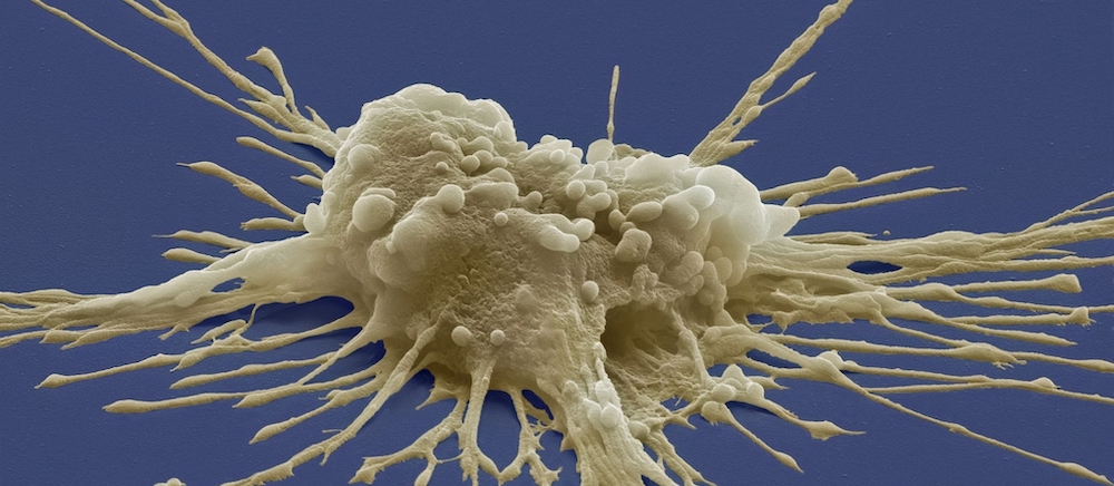 Pluripotent-stem-cells